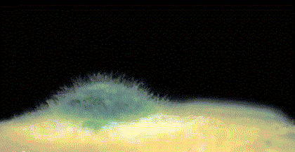 皇冠信用网代理_6岁女童发烧17天皇冠信用网代理，脑子竟被“啃”出十几个洞！“元凶”家中很常见！